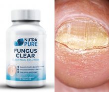 NutraPure Clear Fungus Review