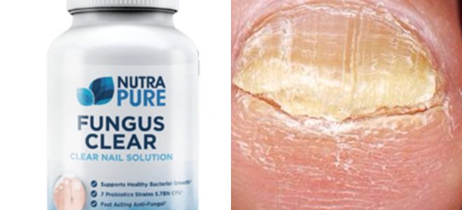 NutraPure Clear Fungus Review